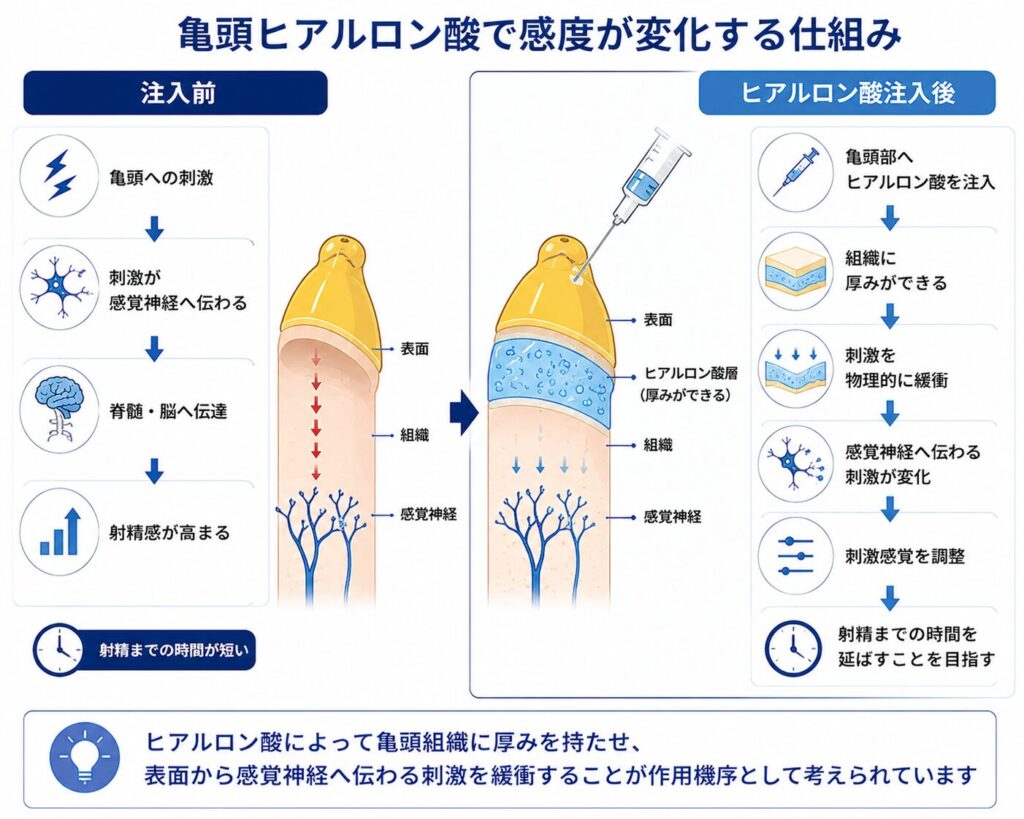 亀頭ヒアルロン酸によって組織に厚みを持たせ感覚神経へ伝わる刺激を緩衝する仕組み