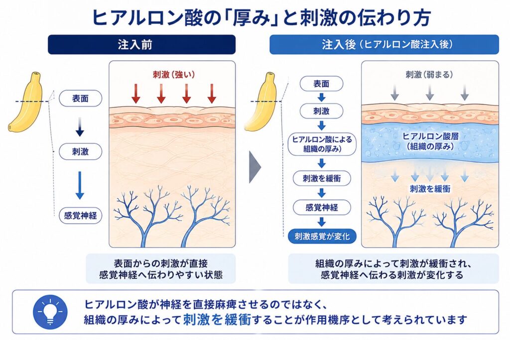 亀頭ヒアルロン酸による組織の厚みが表面刺激を緩衝して感覚神経への刺激を変化させる模式図