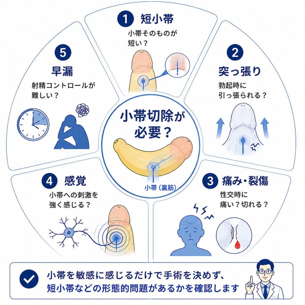 早漏で陰茎小帯切除を検討するときに短小帯・突っ張り・痛み・感覚・射精コントロールを確認する図
