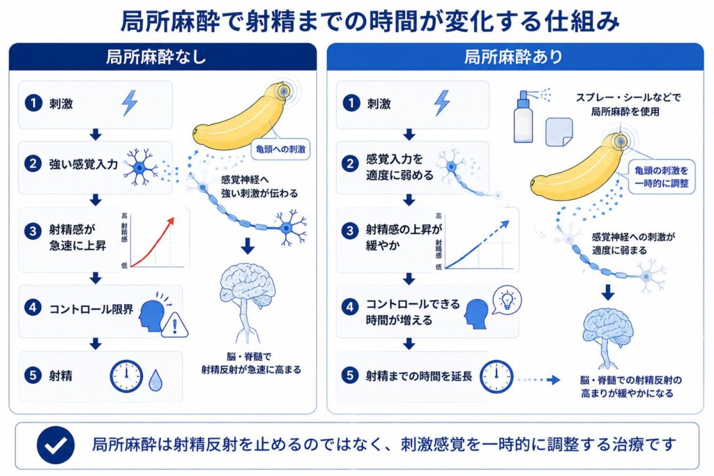 早漏に局所麻酔を使用して刺激感覚を弱め射精感の上昇を緩やかにする仕組み